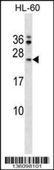 FAIM Antibody (Center)