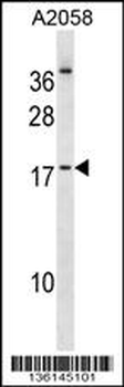 NHLH2 Antibody (Center)
