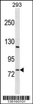 RBAK Antibody (N-term)