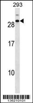 CDCA4 Antibody (C-term)