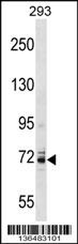 KCNC4 Antibody (C-term)
