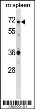 SH3BP2 Antibody (Center)