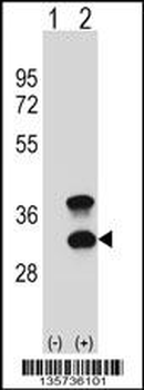 CD79B Antibody (Center)