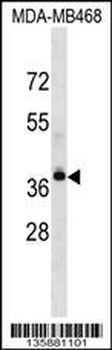 LPAR4 Antibody (Center)
