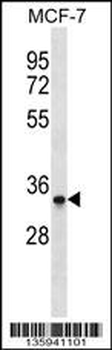 MAD2L1BP Antibody (N-term)