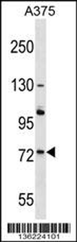 ACOX2 Antibody (N-term)