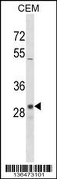 OR1D2 Antibody (C-term)