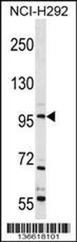 TRPC4 Antibody (C-term)