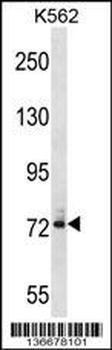 DNAI1 Antibody (N-term)