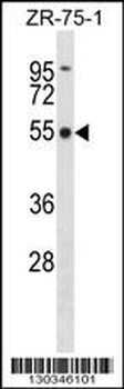 FBXO5 Antibody (Center)
