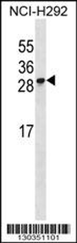 RFESD Antibody (Center)