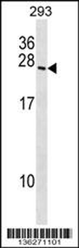 BOK Antibody (N-term)