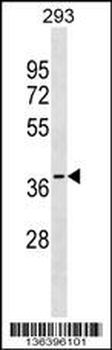 GGPS1 Antibody (Center)
