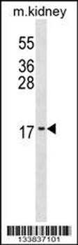 ID3 Antibody (N-term)