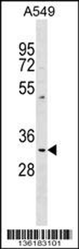 PPT1 Antibody (Center)
