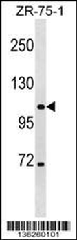 CLCN3 Antibody (Center)