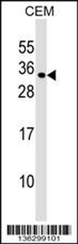 MXD1 Antibody (N-term)