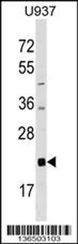 AKIRIN2 Antibody (C-term)