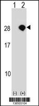 AKIRIN2 Antibody (C-term)