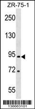 RTN1 Antibody (N-term)