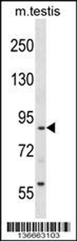 RTN1 Antibody (N-term)
