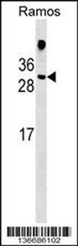 HDGFL1 Antibody (Center)