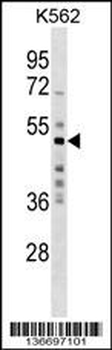 MKRN2 Antibody (N-term)