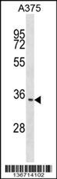 ITM2C Antibody (N-term)