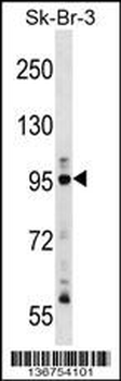 TTK Antibody (N-term)