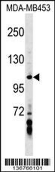 AXIN1 Antibody (Center)