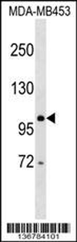 DDX24 Antibody (Center)