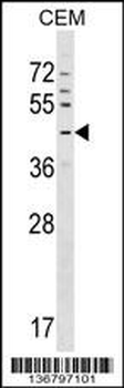 GPR63 Antibody (C-term)