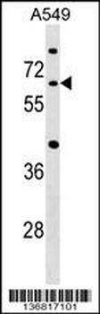 CDC14A Antibody (C-term)