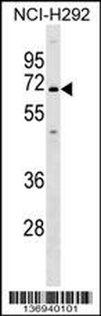 KCNN1 Antibody (C-term)