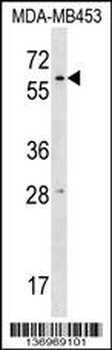 RPUSD2 Antibody (N-term)