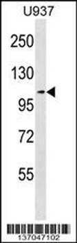 MCC Antibody (Center)