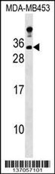 LIN7A Antibody (C-term)