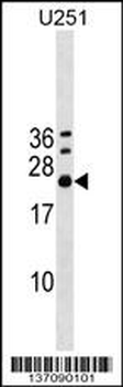 EXOSC4 Antibody (Center)