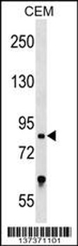 TCF25 Antibody (N-term)
