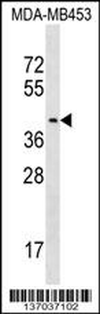 PSG9 Antibody (Center)