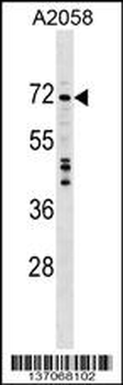 DDX56 Antibody (C-term)