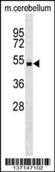 Mouse Stk4 Antibody (C-term)