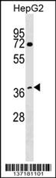 WDR68 Antibody (C-term)