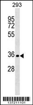 SIX2 Antibody (Center)