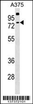 TKTL2 Antibody (N-term)