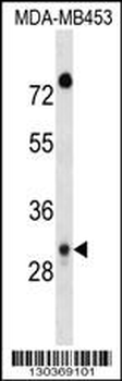DAPP1 Antibody (C-term)