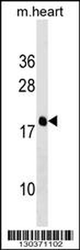PDE6D Antibody (Center)