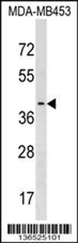 PAFAH2 Antibody (Center)