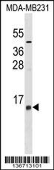 LST1 Antibody (Center)