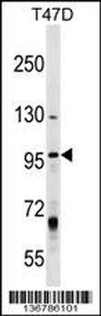 MCM8 Antibody (Center)